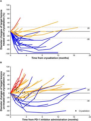 Argon-helium knife cryoablation plus programmed cell death protein 1 inhibitor in the treatment of advanced soft tissue sarcomas: there is no evidence of the synergistic effects of this combination therapy